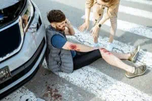 Injured man sitting on the street by a car, talking on a phone, with visible wounds; another person is standing nearby offering assistance.